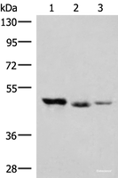 Western blot analysis of K562 and Jurkat cell Mouse kidney tissue lysates using HMBOX1 Polyclonal Antibody at dilution of 1:500