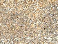 Immunohistochemistry of paraffin-embedded Human tonsil tissue using NAPRT Polyclonal Antibody at dilution of 1:50 (×200)