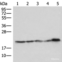 Western blot analysis of Hela HepG2 Jurkat and PC3 cell Mouse kidney tissue lysates using ATP5PD Polyclonal Antibody at dilution of 1:550