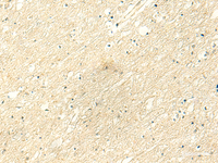 Immunohistochemistry of paraffin-embedded Human brain tissue using POLR3F Polyclonal Antibody at dilution of 1:50 (×200)