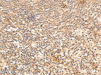 Immunohistochemistry of paraffin-embedded Human tonsil tissue using TRAPPC1 Polyclonal Antibody at dilution of 1:60 (×200)