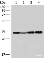 Western blot analysis of 293T and Hela cell Human fetal liver tissue lysates using ECH1 Polyclonal Antibody at dilution of 1:300