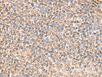 Immunohistochemistry of paraffin-embedded Human tonsil tissue using IQCD Polyclonal Antibody at dilution of 1:60 (×200)