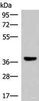 Western blot analysis of Mouse liver tissue lysate using LRG1 Polyclonal Antibody at dilution of 1:1000