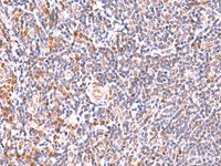 Immunohistochemistry of paraffin-embedded Human tonsil tissue using GMDS Polyclonal Antibody at dilution of 1:55 (×200)