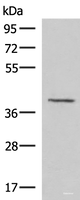 Western blot analysis of Human fetal brain tissue lysate using MECR Polyclonal Antibody at dilution of 1:1000