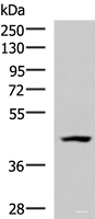Western blot analysis of 293T cell lysate using MAGEC2 Polyclonal Antibody at dilution of 1:700