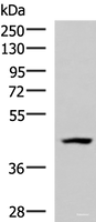 Western blot analysis of 293T cell lysate using MAGEC2 Polyclonal Antibody at dilution of 1:700