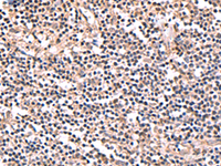 Immunohistochemistry of paraffin-embedded Human tonsil tissue using PER3 Polyclonal Antibody at dilution of 1:70 (×200)