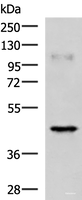 Western blot analysis of Human muscle tissue lysate using RAB3IL1 Polyclonal Antibody at dilution of 1:1000