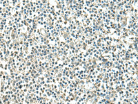 Immunohistochemistry of paraffin-embedded Human tonsil tissue using ATP6V1C1 Polyclonal Antibody at dilution of 1:100 (×200)