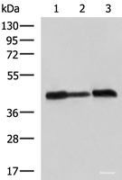 Western blot analysis of A549 Hela and HepG2 cell lysates using PDHA1 Polyclonal Antibody at dilution of 1:750