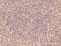 Immunohistochemistry of paraffin-embedded Human tonsil tissue using UBAC1 Polyclonal Antibody at dilution of 1:60 (×200)