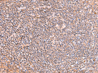 Immunohistochemistry of paraffin-embedded Human tonsil tissue using PHKG2 Polyclonal Antibody at dilution of 1:60 (×200)