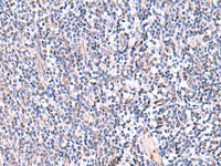 Immunohistochemistry of paraffin-embedded Human tonsil tissue using FDFT1 Polyclonal Antibody at dilution of 1:75 (×200)