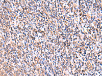 Immunohistochemistry of paraffin-embedded Human tonsil tissue using UXS1 Polyclonal Antibody at dilution of 1:60 (×200)