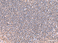 Immunohistochemistry of paraffin-embedded Human tonsil tissue using RIC8A Polyclonal Antibody at dilution of 1:80 (×200)