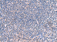 Immunohistochemistry of paraffin-embedded Human tonsil tissue using SCCPDH Polyclonal Antibody at dilution of 1:50 (×200)
