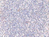 Immunohistochemistry of paraffin-embedded Human tonsil tissue using IFT57 Polyclonal Antibody at dilution of 1:85 (×200)