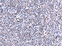 Immunohistochemistry of paraffin-embedded Human tonsil tissue using KIR3DL1 Polyclonal Antibody at dilution of 1:105 (×200)