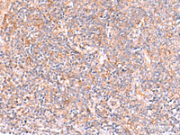 Immunohistochemistry of paraffin-embedded Human tonsil tissue using NADK Polyclonal Antibody at dilution of 1:95 (×200)