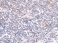 Immunohistochemistry of paraffin-embedded Human tonsil tissue using INPP5K Polyclonal Antibody at dilution of 1:85 (×200)