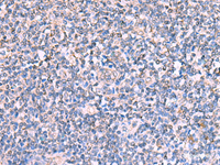 Immunohistochemistry of paraffin-embedded Human tonsil tissue using FDXR Polyclonal Antibody at dilution of 1:110 (×200)