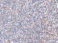 Immunohistochemistry of paraffin-embedded Human tonsil tissue using PEPD Polyclonal Antibody at dilution of 1:85 (×200)