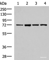Western blot analysis of Jurkat cell Mouse liver tissue HepG2 cell Mouse kidney tissue lysates using ZAP70 Polyclonal Antibody at dilution of 1:800