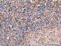 Immunohistochemistry of paraffin-embedded Human tonsil tissue using ARIH2 Polyclonal Antibody at dilution of 1:70 (×200)