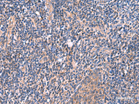 Immunohistochemistry of paraffin-embedded Human tonsil tissue using MYOT Polyclonal Antibody at dilution of 1:70 (×200)