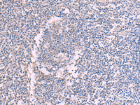 Immunohistochemistry of paraffin-embedded Human tonsil tissue using CCT5 Polyclonal Antibody at dilution of 1:60 (×200)