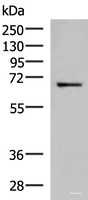 Western blot analysis of 231 cell lysate using GSPT2 Polyclonal Antibody at dilution of 1:650