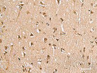 Immunohistochemistry of paraffin-embedded Human brain tissue using NVL Polyclonal Antibody at dilution of 1:70 (×200)