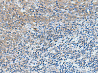 Immunohistochemistry of paraffin-embedded Human tonsil tissue using GPCPD1 Polyclonal Antibody at dilution of 1:50 (×200)