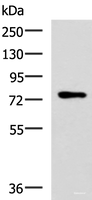 Western blot analysis of Mouse thymus tissue lysate using L3MBTL2 Polyclonal Antibody at dilution of 1:800