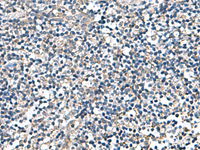 Immunohistochemistry of paraffin-embedded Human tonsil tissue using DPY19L3 Polyclonal Antibody at dilution of 1:110 (×200)