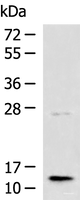 Western blot analysis of Human liver tissue lysate using TMEM141 Polyclonal Antibody at dilution of 1:1000