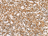 Immunohistochemistry of paraffin-embedded Human tonsil tissue using PHF5A Polyclonal Antibody at dilution of 1:55 (×200)