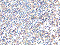 Immunohistochemistry of paraffin-embedded Human tonsil tissue using IFI27 Polyclonal Antibody at dilution of 1:80 (×200)