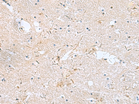 Immunohistochemistry of paraffin-embedded Human brain tissue using FAM107B Polyclonal Antibody at dilution of 1:160 (×200)