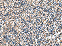 Immunohistochemistry of paraffin-embedded Human tonsil tissue using RPS14 Polyclonal Antibody at dilution of 1:60 (×200)