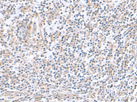 Immunohistochemistry of paraffin-embedded Human tonsil tissue using TNNC2 Polyclonal Antibody at dilution of 1:50 (×200)