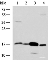 Western blot analysis of Mouse Pancreas tissue Mouse small intestines tissue Mouse large intestine tissue Human sigmoid tissue lysates using ZG16 Polyclonal Antibody at dilution of 1:1350