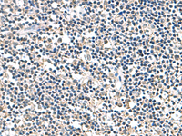 Immunohistochemistry of paraffin-embedded Human tonsil tissue using ATP5F1D Polyclonal Antibody at dilution of 1:80 (×200)