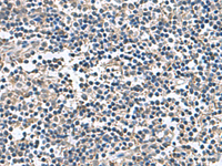 Immunohistochemistry of paraffin-embedded Human tonsil tissue using BLOC1S6 Polyclonal Antibody at dilution of 1:60 (×200)