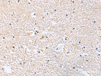 Immunohistochemistry of paraffin-embedded Human brain tissue using EIF4A2 Polyclonal Antibody at dilution of 1:70 (×200)