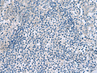 Immunohistochemistry of paraffin-embedded Human tonsil tissue using HPCAL1 Polyclonal Antibody at dilution of 1:90 (×200)