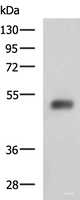 Western blot analysis of Human bladder transitional cell carcinoma grade 2-3 tissue lysate using SLC30A6 Polyclonal Antibody at dilution of 1:2000