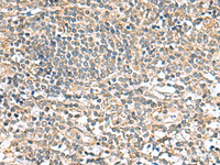 Immunohistochemistry of paraffin-embedded Human tonsil tissue using CCDC134 Polyclonal Antibody at dilution of 1:50 (×200)